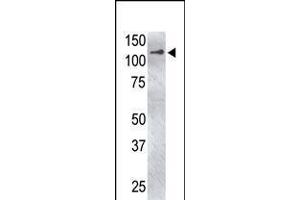 Antibody is used in Western blot to detect USP4 in USP4-transfected HeLa cell lysate. (USP4 antibody  (C-Term))