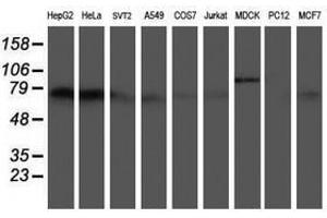 Image no. 2 for anti-5-Aminoimidazole-4-Carboxamide Ribonucleotide Formyltransferase/IMP Cyclohydrolase (ATIC) antibody (ABIN1496504) (ATIC antibody)