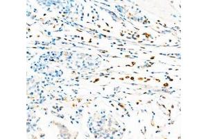IHC analysis of CD68 using anti-CD68 antibody (ABIN7600142). (CD68 antibody  (AA 154-354))
