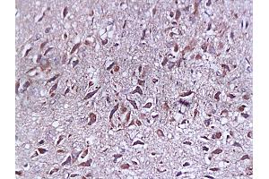 Formalin-fixed and paraffin embedded rat brain tissue labeled with Anti-SYP p38/Synaptophysin/SAP-1 Polyclonal Antibody, Unconjugated (ABIN725285) at 1:200, followed by conjugation to the secondary antibody and DAB staining (SYAP1 antibody  (AA 151-230))