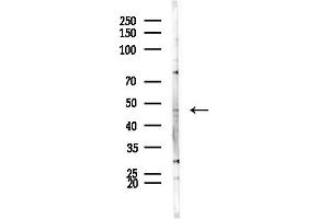 anti-Solute Carrier Family 17 (Anion/Sugar Transporter), Member 2 (SLC17A2) (N-Term) antibody