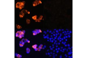 Immunofluorescence analysis of HepG2 cells (upper left) and LO2 cells (negative sample control) (upper right) using Alpha-Fetoprotein (Alpha-Fetoprotein (AFP)) Rabbit pAb (red, ABIN6129175, ABIN6136616, ABIN6136618 and ABIN6215038) at dilution of 1:100. (alpha Fetoprotein antibody  (AA 360-609))