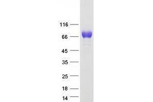 Tyrosinase-Related Protein 1 (TYRP1) protein (Myc-DYKDDDDK Tag)
