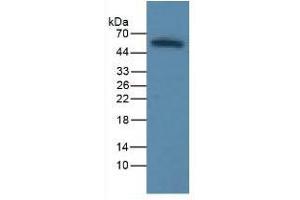 Rabbit Capture antibody from the kit in WB with Positive Control: Human liver tissue. (ICAM1 CLIA Kit)
