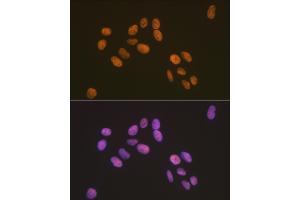 Immunofluorescence analysis of U-2 OS cells using ZBTB7A/FBI-1/LRF Rabbit mAb (ABIN7271439) at dilution of 1:100 (40x lens). (ZBTB7A antibody)