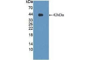 Detection of Recombinant LPHN3, Human using Polyclonal Antibody to Latrophilin 3 (LPHN3) (LPHN3 antibody  (AA 1105-1447))