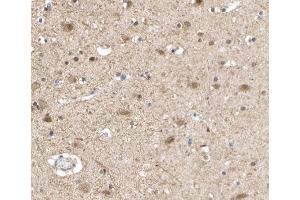 ABIN6266632 at 1/100 staining human brain tissue sections by IHC-P.