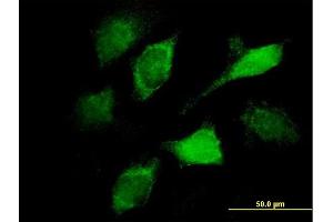 Immunofluorescence of monoclonal antibody to VAV1 on HeLa cell. (VAV1 antibody  (AA 681-790))