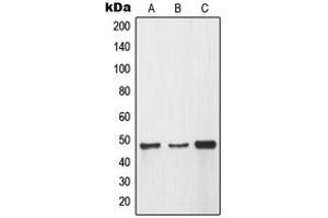 Western blot analysis of MMP12 expression in A549 (A), HEK293 (B), HeLa (C) whole cell lysates. (MMP12 antibody  (Center))