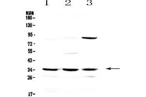 Western blot analysis of Alpha 1 microglobulin using anti-Alpha 1 microglobulin antibody . (AMBP antibody  (AA 206-352))
