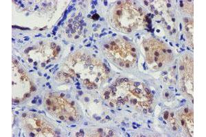 Immunohistochemical staining of paraffin-embedded Human Kidney tissue using anti-FBXO21 mouse monoclonal antibody. (FBXO21 antibody)
