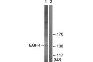 Western blot analysis of extracts from A431 cells, using EGFR (Ab-693) Antibody.