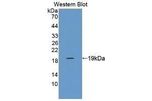 Detection of Recombinant MARCO, Rat using Polyclonal Antibody to Macrophage Receptor With Collagenous Structure (MARCO) (MARCO antibody  (AA 367-519))