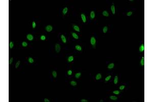 Immunofluorescent analysis of Hela cells (sodium butyrate, 30 mM, 4h) using ABIN7139191 at dilution of 1:100 and Alexa Fluor 488-congugated AffiniPure Goat Anti-Rabbit IgG(H+L) (HIST1H1E antibody  (acLys63))
