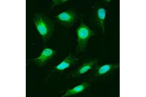 IF analysis of USP25 using anti-USP25 antibody (ABIN7598940).