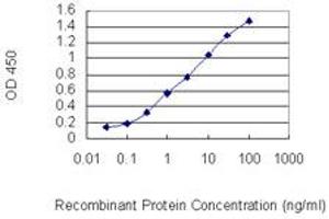 Detection limit for recombinant GST tagged IL15 is 0. (IL-15 antibody  (AA 30-129))