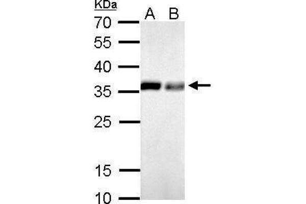 Pyrophosphatase (Inorganic) 1 (PPA1) antibody