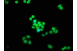 Immunofluorescence staining of PC-3 cells with ABIN7170484 at 1:133, counter-stained with DAPI. (SPAG8 antibody  (AA 236-409))