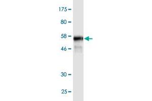 Western Blot detection against Immunogen (59. (PKD1L2 antibody  (AA 1-306))