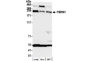 Western Blotting (WB) image for anti-Polybromo 1 (PBRM1) (AA 1639-1689) antibody (ABIN7453903) (Polybromo 1 antibody  (AA 1639-1689))