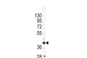 Western blot analysis of OL1 Antibody (C-term) 7361b in SK-Br-3 cell line lysates (35 μg/lane). (APOL1 antibody  (C-Term))