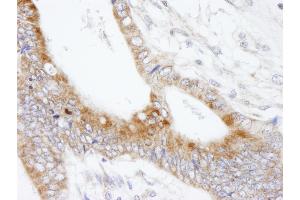 anti-Microtubule-Associated Protein 7 (MAP7) (AA 720-749) antibody
