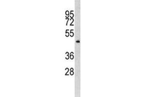 Western blot analysis of ILK antibody and MDA-MB435 lysate. (ILK antibody  (AA 321-350))