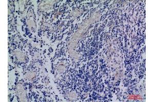 Immunohistochemistry (IHC) analysis of paraffin-embedded Human Brain, antibody was diluted at 1:100. (CXCR3 antibody  (Internal Region))
