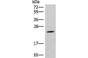 Western blot analysis of Mouse brain tissue lysate using TBPL1 Polyclonal Antibody at dilution of 1:400