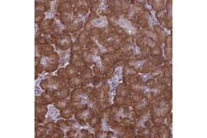 Immunohistochemical staining of human pancreas with RPS19BP1 polyclonal antibody  shows strong cytoplasmic with additional nucleolar positivity in exocrine glandular cells at 1:500-1:1000 dilution. (RPS19BP1 antibody)