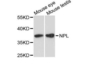 Western blot analysis of extracts of various cell lines, using NPL antibody. (NPL antibody)