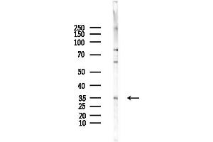 anti-Ribosomal Protein L5 (RPL5) (C-Term) antibody