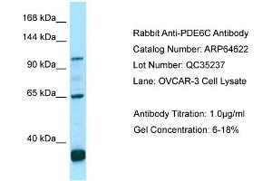 Western Blotting (WB) image for anti-phosphodiesterase 6C, CGMP-Specific, Cone, alpha Prime (PDE6C) (C-Term) antibody (ABIN2774403)
