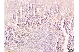 Formalin-fixed and paraffin embedded mouse spleen tissue labeled with Anti-TRAIL Polyclonal Antibody, Unconjugated (ABIN673494) at 1:200 followed by conjugation to the secondary antibody and DAB staining. (TRAIL antibody  (AA 185-281))