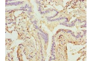 Immunohistochemistry of paraffin-embedded human lung tissue using ABIN7176151 at dilution of 1:100 (ZNF212 antibody  (AA 1-495))
