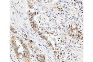 IHC analysis of AKAP 95/AKAP8 using anti-AKAP 95/AKAP8 antibody (ABIN7601553). (AKAP8 antibody  (AA 380-546))