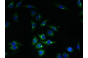Immunofluorescent analysis of A549 cells using ABIN7150922 at dilution of 1:100 and Alexa Fluor 488-congugated AffiniPure Goat Anti-Rabbit IgG(H+L) (KIAA319L (AA 479-718) antibody)
