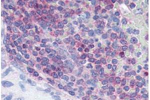 Human Spleen (formalin-fixed, paraffin-embedded) stained with XCR1 antibody ABIN213355 at 2. (XCR1 antibody  (Extracellular Domain))