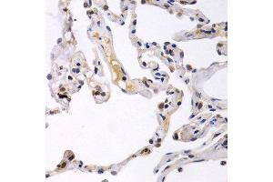 Immunohistochemistry of paraffin-embedded human normal lung using OAS1 antibody at dilution of 1:200 (400x lens). (OAS1 antibody)