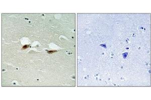 Immunohistochemical analysis of paraffin-embedded human brain tissue using ATF-2 (Phospho-Ser472) antibody (left)or the same antibody preincubated with blocking peptide (right). (ATF2 antibody  (pSer472))
