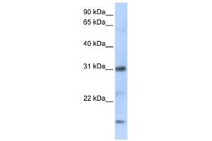 CXCL16 antibody used at 1 ug/ml to detect target protein.