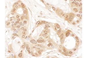 Immunohistochemistry (IHC) image for anti-Chloride Channel, Nucleotide-Sensitive, 1A (CLNS1A) (AA 187-237) antibody (ABIN7455042) (CLNS1A antibody  (AA 187-237))