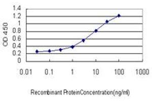 Detection limit for recombinant GST tagged CILP is approximately 0. (CILP antibody  (AA 129-226))