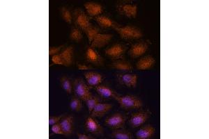 Immunofluorescence analysis of C6 cells using UPF3A antibody (ABIN7271227) at dilution of 1:100. (UPF3A antibody  (AA 327-476))