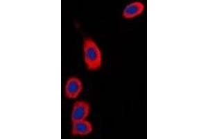 Immunofluorescent analysis of RPS6KC1 staining in Hela cells. (RPS6KC1 antibody)