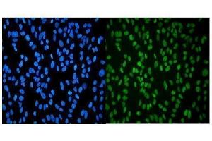 IF analysis of HP1 alpha/CBX5 using anti-HP1 alpha/CBX5 antibody (ABIN7599058). (CBX5 antibody  (AA 1-191))