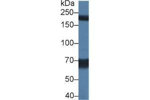 Detection of TRPM7 in Rat Serum using Polyclonal Antibody to Transient Receptor Potential Cation Channel Subfamily M, Member 7 (TRPM7) (TRPM7 antibody  (AA 19-179))