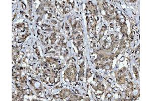 IHC analysis of CSNK2K2 using anti-CSNK2K2 antibody (ABIN7602871). (CSNK2A2 antibody  (C-Term))