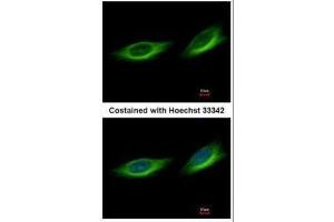 ICC/IF Image Immunofluorescence analysis of methanol-fixed HeLa, using TULP1, antibody at 1:500 dilution. (TULP1 antibody)