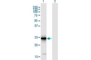 Western Blot analysis of FIBIN expression in transfected 293T cell line ( H00387758-T01 ) by FIBIN MaxPab polyclonal antibody. (FIBIN antibody  (AA 1-211))